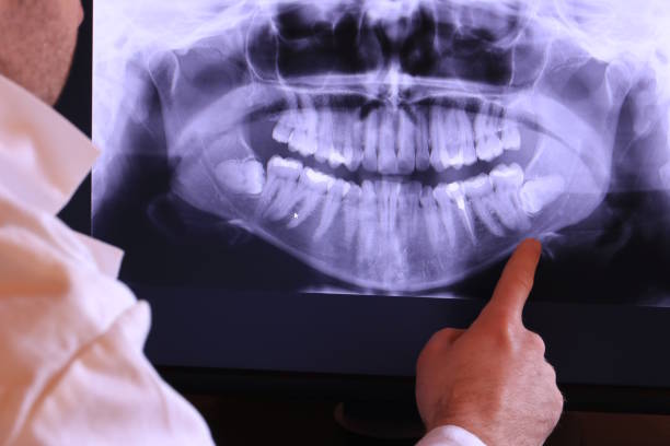 Best Cracked Tooth Emergency Dentist  in Langhorne Manor, PA